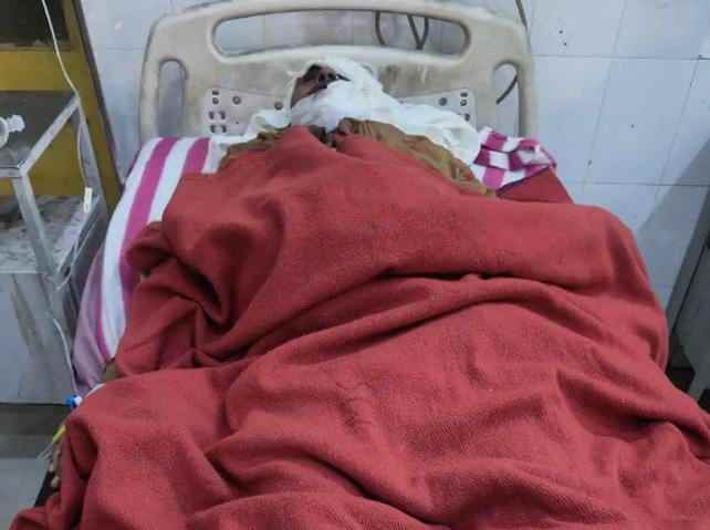 पति-पत्नी पर हमला घर में तोड़-फोड़ अज्ञात हमलावरों ने देर रात वारदात को दिया अंजाम